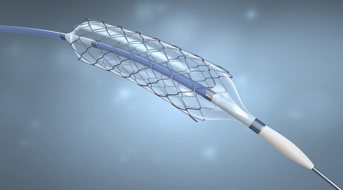 Advanced cardiac stent technology showcased by an engineering university.