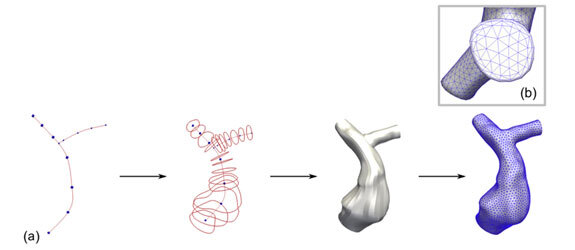 "Progression from geometric abstraction to detailed 3D bone model for biomechanical applications."