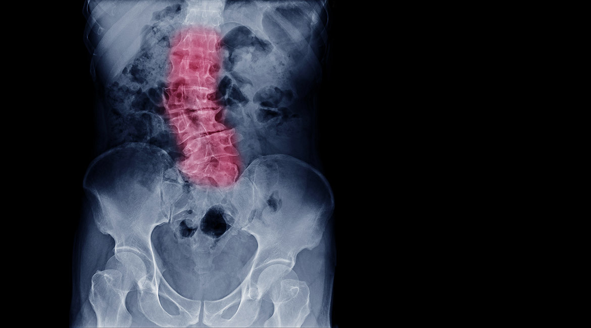 Advanced medical imaging highlighting lumbar spine area, illustrating cutting-edge diagnostic technology.