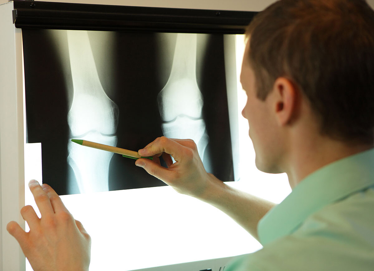 Radiologist examining the X-ray of a lower limb.