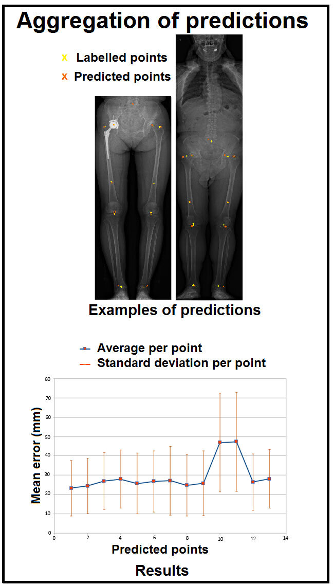 Results of the automatic identification method of areas of interest on X-rays.